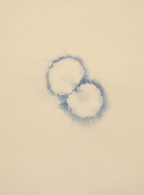 Andrea Fogli - serie IL GIARDINO PLANETARIO - ombelico di Venere , P.Paradise di J.Beuys